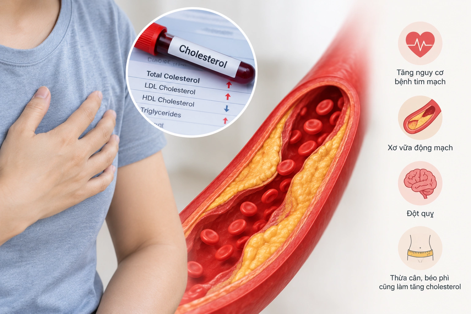Hình minh họa: Vai trò của cholesterol đối với cơ thể
