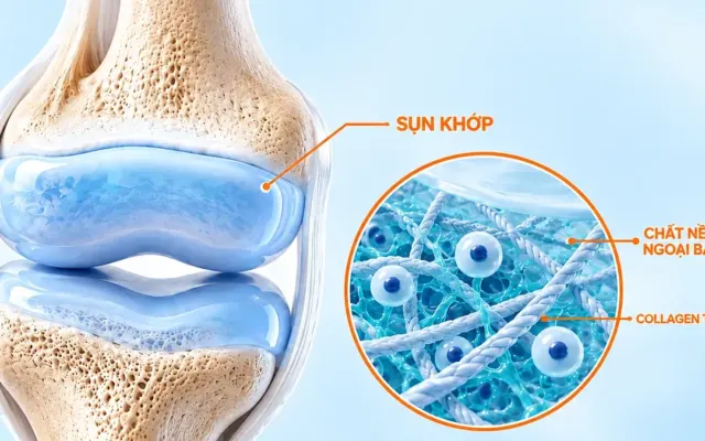 5 dấu hiệu sụn khớp suy yếu