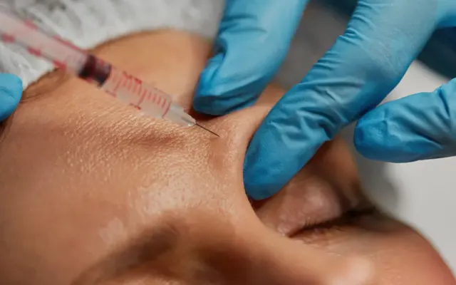 Da người hiến tặng ở Mỹ thành nguyên liệu tiêm thẩm mỹ bạc tỷ tại Hàn Quốc