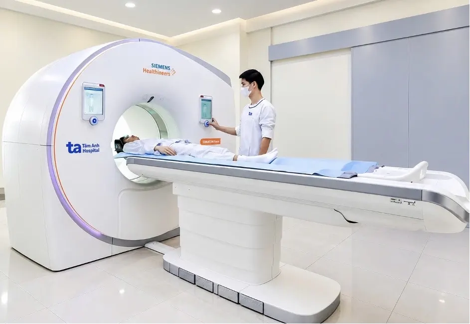 Hình minh họa: Đau đầu kéo dài có phải dấu hiệu túi phình mạch máu não?