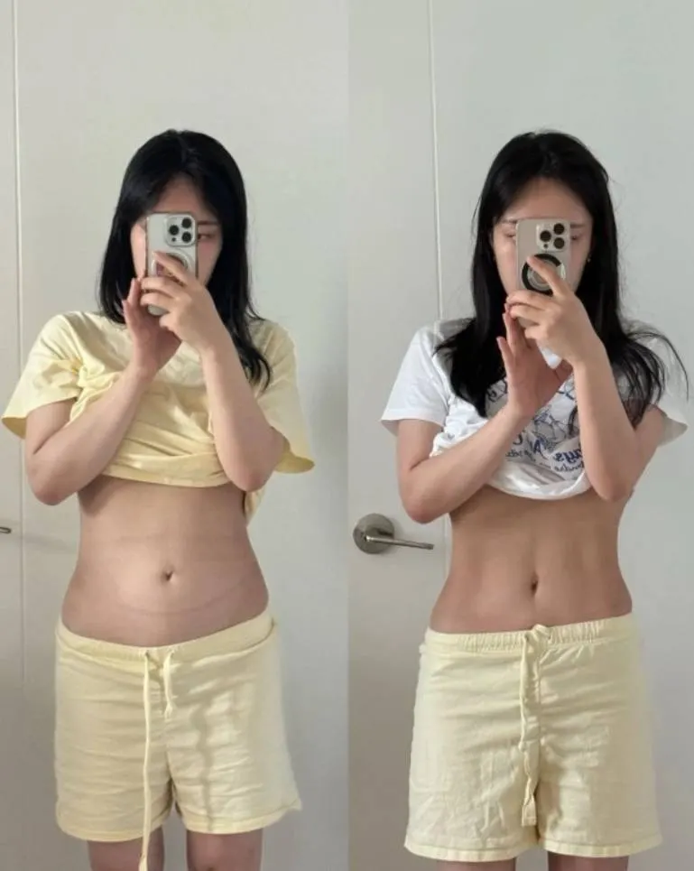 Hình minh họa: YouTuber Hàn Quốc giảm 20 kg ‘lột xác’ trẻ trung