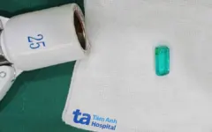Cấy đá phong thủy vào vùng kín ‘cầu có con’