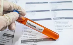 Giới khoa học theo dõi biến đổi của H1N1 để dự báo mùa cúm