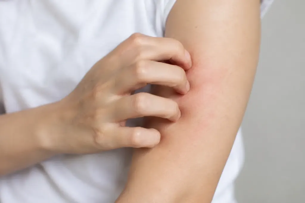 Hình minh họa: 5 dấu hiệu trên da cảnh báo tổn thương thận