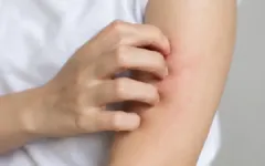 5 dấu hiệu trên da cảnh báo tổn thương thận