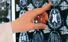 Hai người ở Cà Mau mắc não mô cầu, một ca tử vong