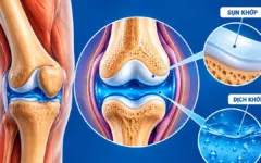 Sụn khớp được nuôi dưỡng như thế nào