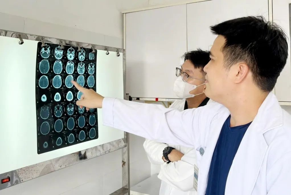 Hình minh họa: Răng hàm xuyên qua sọ nam sinh sau va chạm giao thông